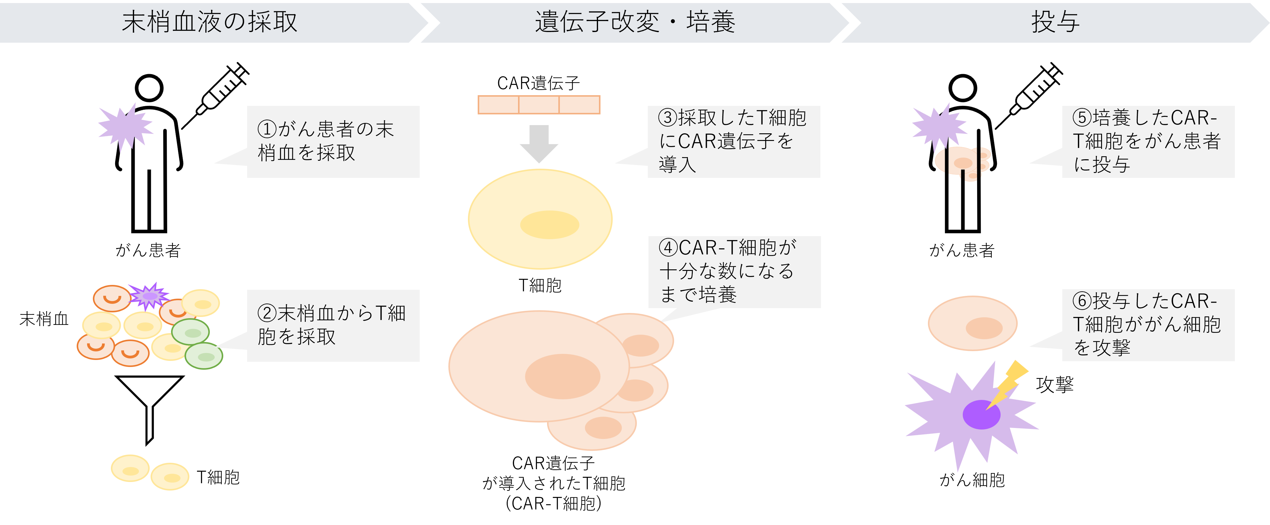 製造~投与までのプロセス